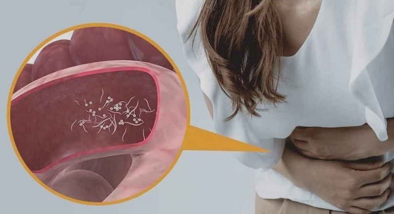 শরীরের যে ৫ লক্ষণ বলে দেবে কৃমি বাসা বেঁধেছে কি না